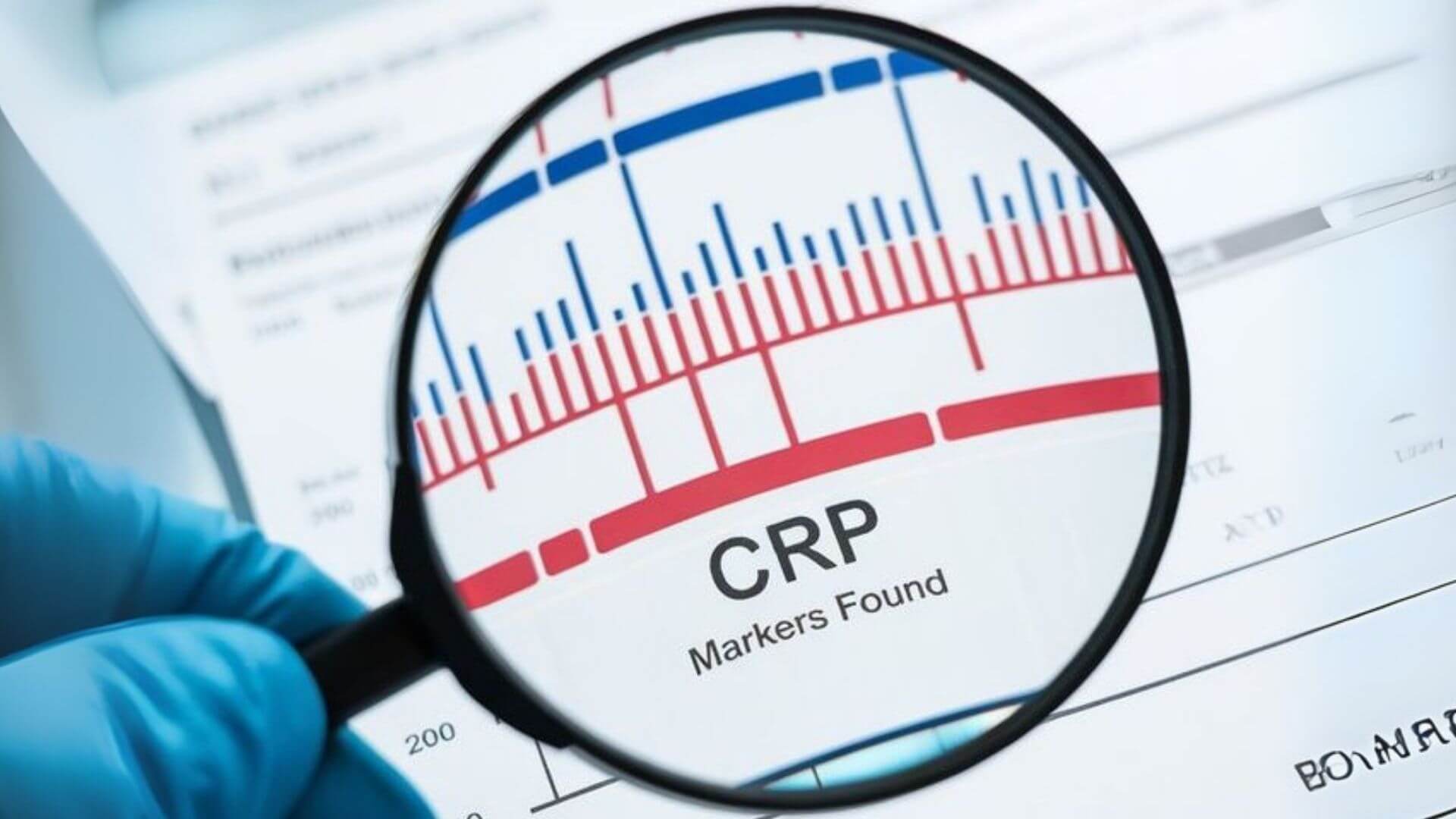 CRP: Enflamasyon Kontrol Noktası